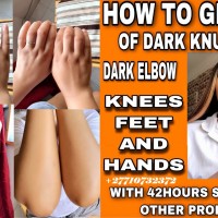 Permanent Skin Bleaching And Whitening Products In Saint John In Barbados Call ☏ +27710732372