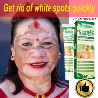 +2771 073 2372 Get Rid Of Vitiligo In Akwatia Town in Ghana
