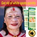 Get Rid Of Vitiligo In Panicale Town In Italy Call +27710732372 Scars And Stretch Marks In Australia